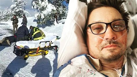 did jeremy renner lose his leg|Jeremy Renners snowplow ran over his leg: reports